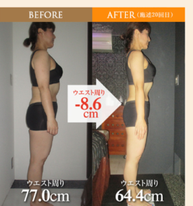 ビフォーアフター ５ ブログ Lunasia ルナシア 京都烏丸 大阪梅田のインドエステ発の痩身マッサージ エステサロン